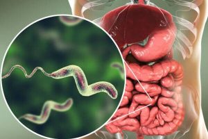 Cayman records one case of cyclosporiasis