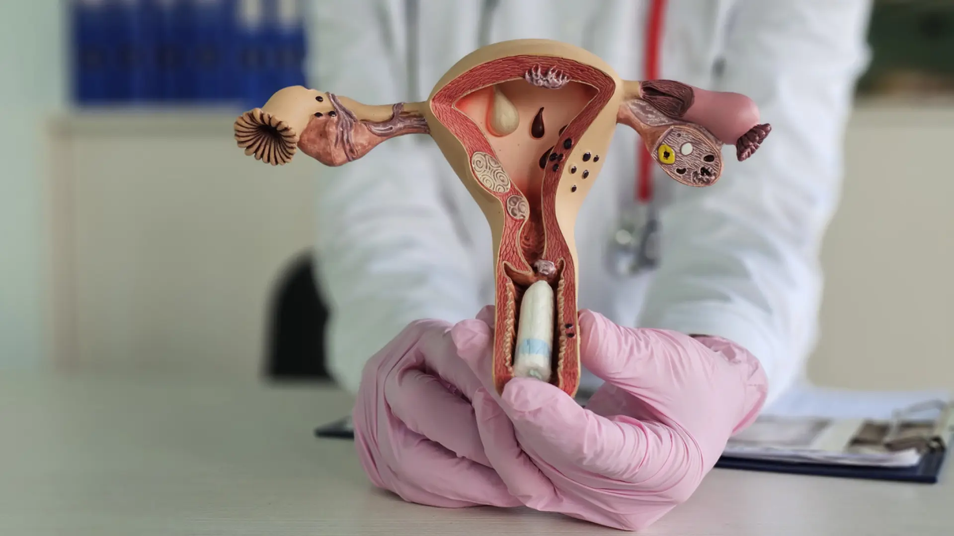  ¿Compresa, tampón o copa menstrual? Una ginecóloga analiza los riesgos de cada uno 